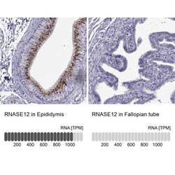 RNASE12 Antibody, Novus Biologicals 0.1mL; Unlabeled:Antibodies, Polyclonal